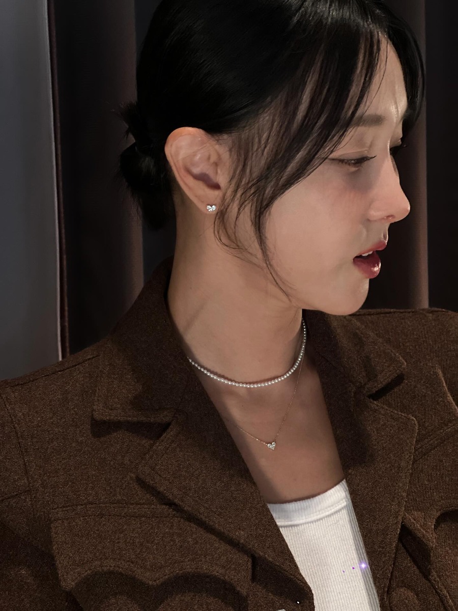 이지혜 실리프팅 중안부 인중축소