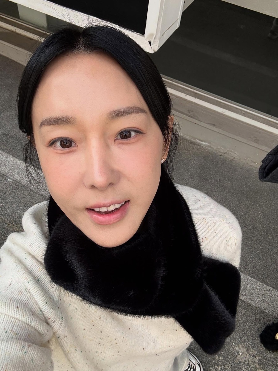 이지혜 실리프팅 중안부 인중축소