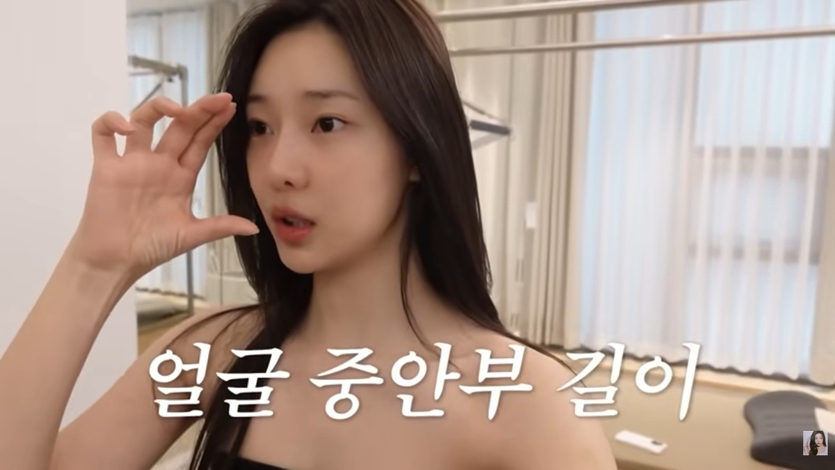 이시안 얼굴교정 중안부