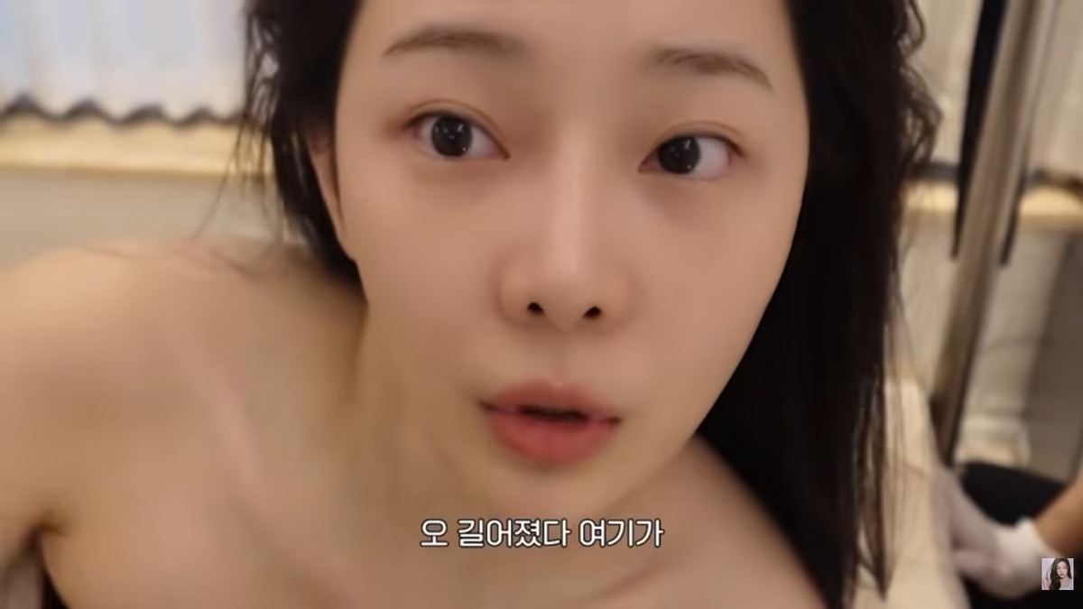 이시안 얼굴교정